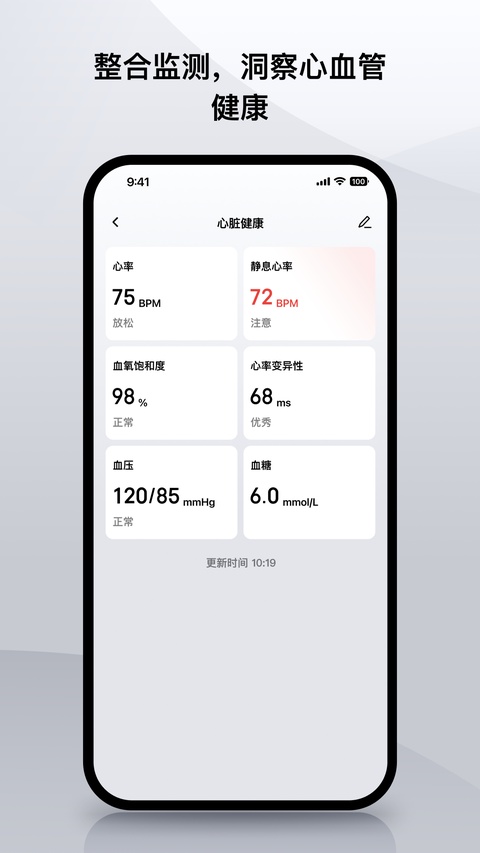 Amazfit手表