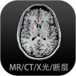 影像解剖图谱