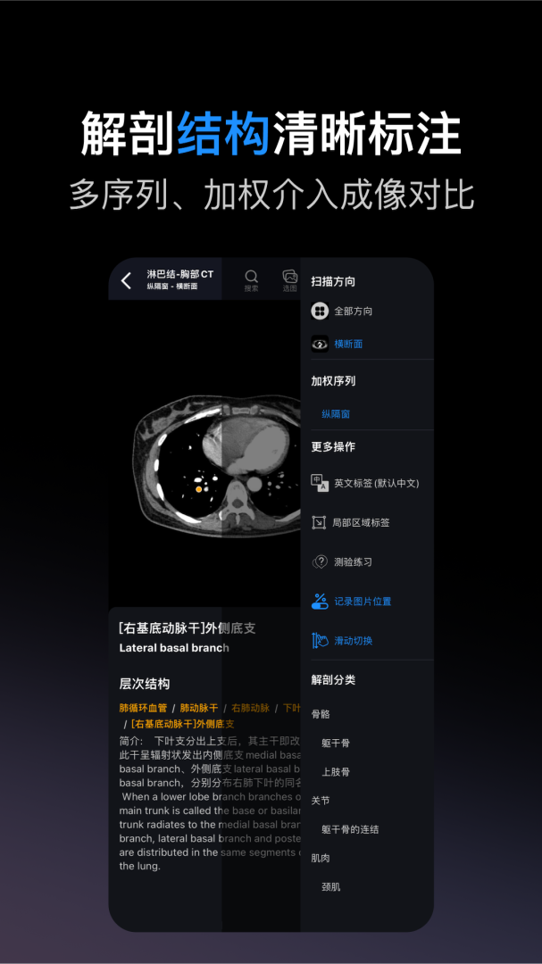 影像解剖图谱